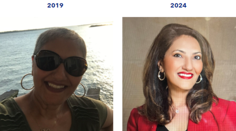 Before and after images or hair growth results.